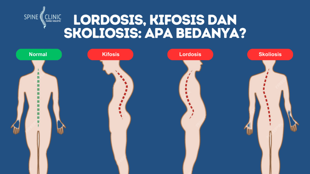 Lordosis kifosis dan skoliosis