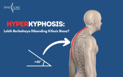 Hiperkifosis: Mengapa Lebih Berbahaya Dibanding Kifosis Biasa?
